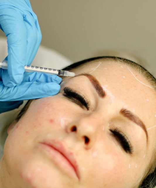 Brow Lift