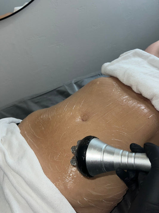 Cavitation (Skin Tightening for Body)